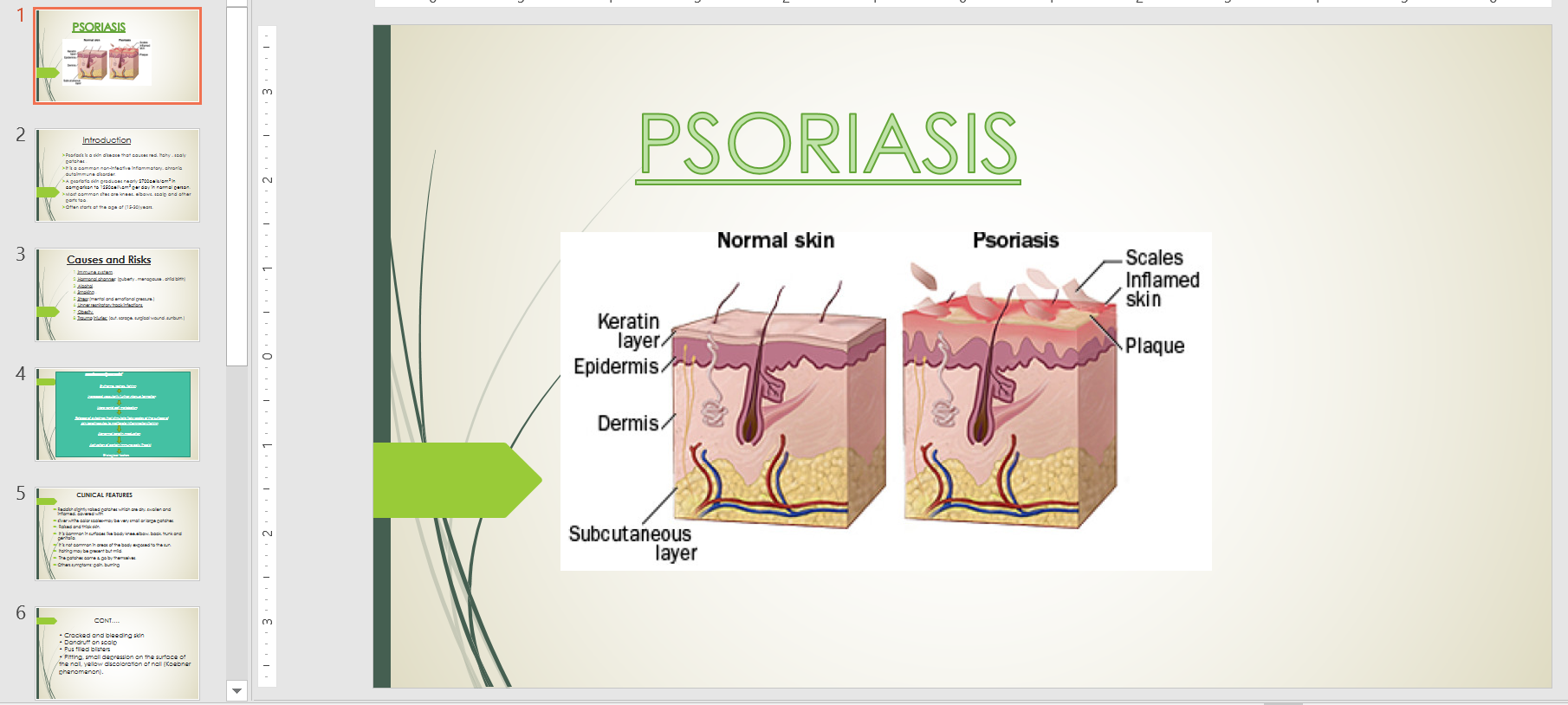 Intro to Psoriasis